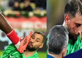 পিএসজির গোলরক্ষক দোন্নারুম্মার মুখ প্রতিপক্ষের বুটের আঘাতে ক্ষতবিক্ষত